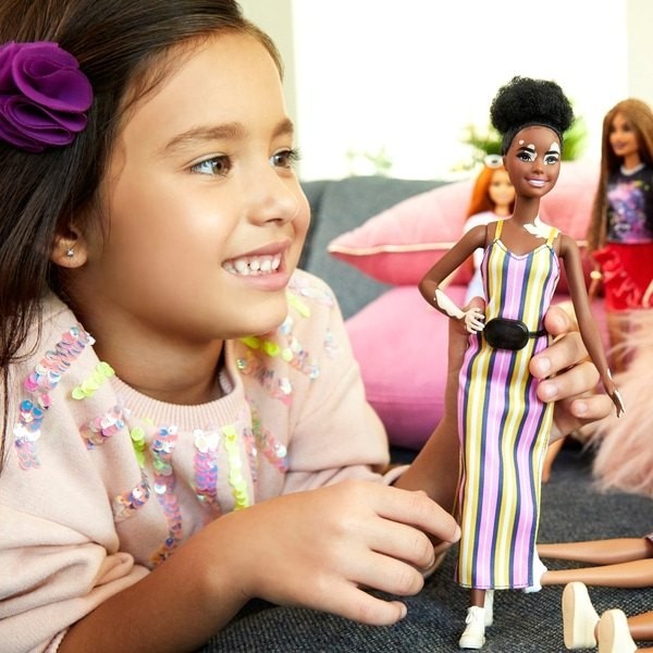 Price Cut - Barbie Fashionista Dolly 135 Vitiligo Figurine - Crazy Deal-O-Rama:£9